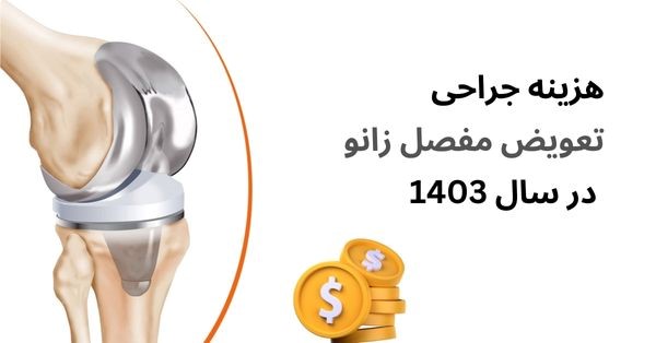 هزینه تعویض مفصل زانو در سال 1403 چقدر است؟